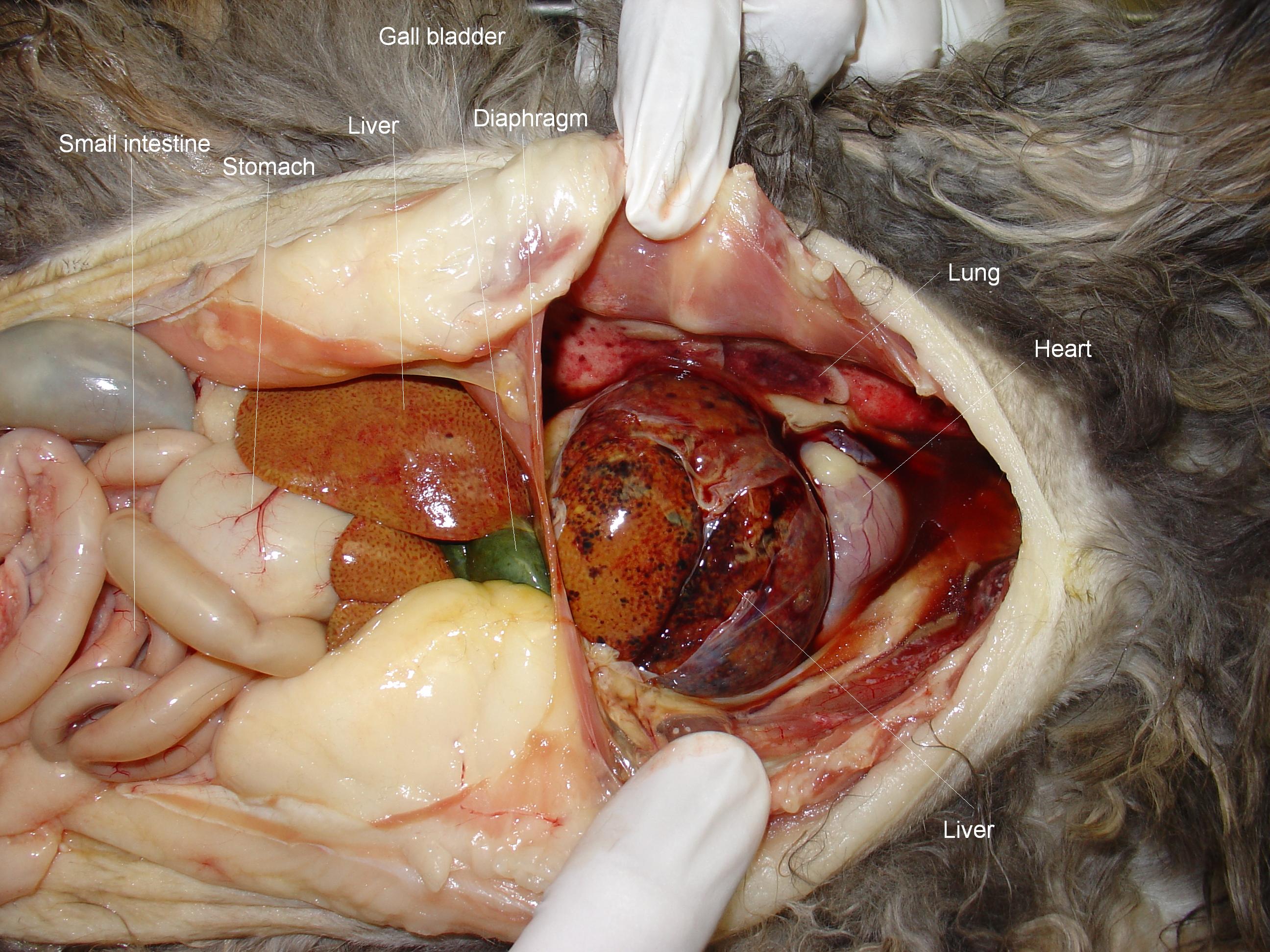 Peritoneopericardial diaphragmatic hernia