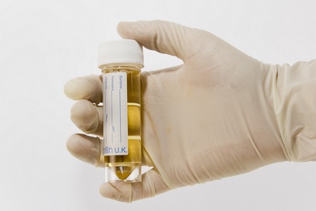 campione esame delle urine cane gatto