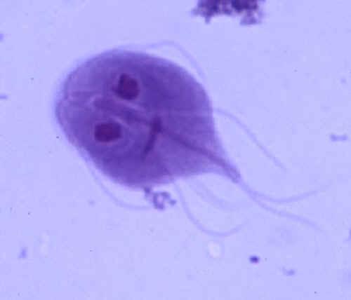 giardia